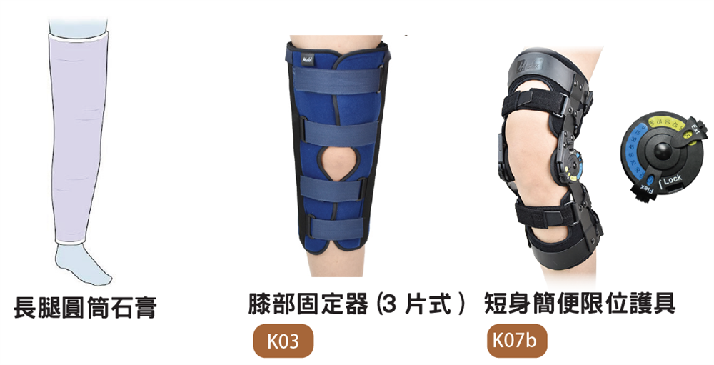 髕骨骨折